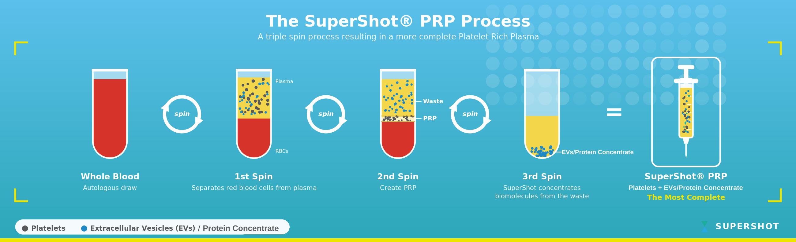 The SuperShot PRP Process: a triple spin process resulting in a more complete Platelet Rich Plasma